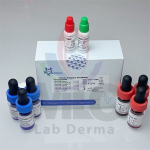 WIDAL TEST determination of Febrile Antigens 100 test