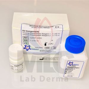 ALKALINE PHOSPHATASE determination of ALP in serum R1;40ML R2;10ML 50 TEST