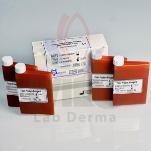 TOTAL PROTEIN KIT