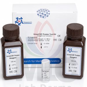 Urine&Csf Protein